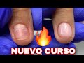 NUEVO CURSO ONLINE💜 | Uñas mordidas😢