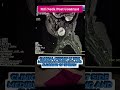 neck post Contrast left side MEDIBULAR for speech of speak SWALLOW #mri #mri #mri #mri #mri #mri