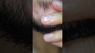 Beard hair therapy #asmr #relaxing #massage #therapy #satisfying #relax #shorts #video #viral