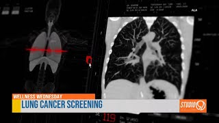 Wellness Wednesday: Pulmonologist explains lung cancer screenings