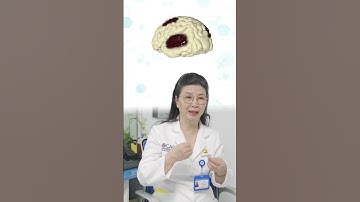 Bị đột quỵ nhồi máu não có chữa khỏi được không?