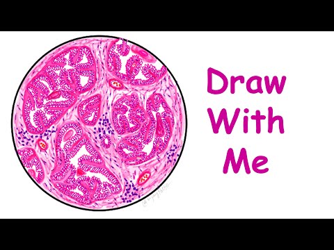 Benign Prostatic Hyperplasia- Draw With Me!