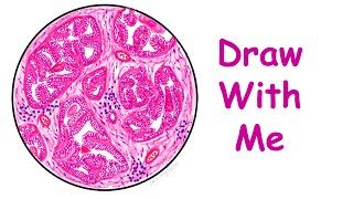 Benign Prostatic Hyperplasia-  Draw With Me!