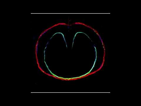 XTC - We're All Light