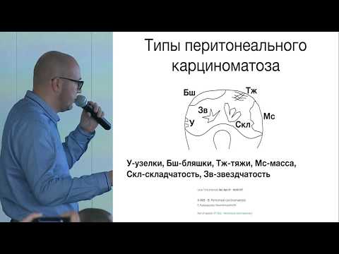 Видео: Покажет ли рак яичников компьютерная томография?