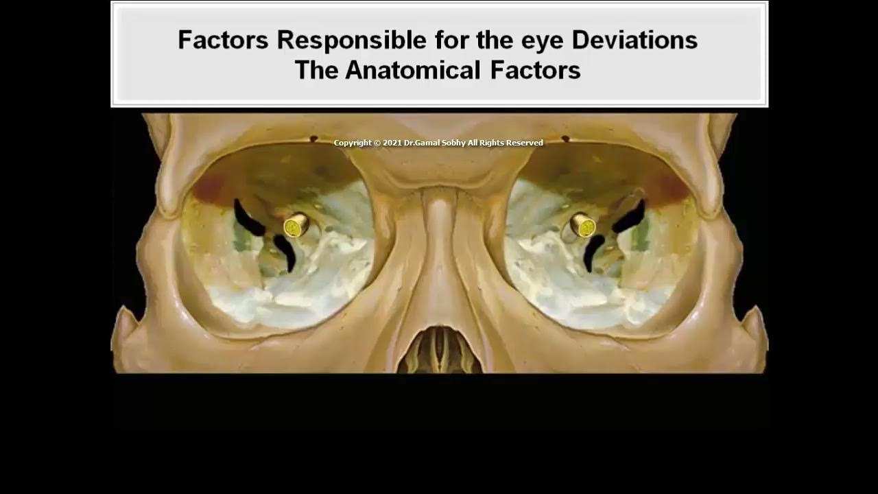 9 Etiology of Heterophoria and Heterotropia Animated Book Binocular