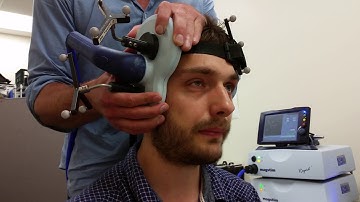 cTBS (rTMS) over right Inferior Frontal Gyrus