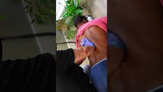 His #scoliosis has been tightening up his back while performing sports!