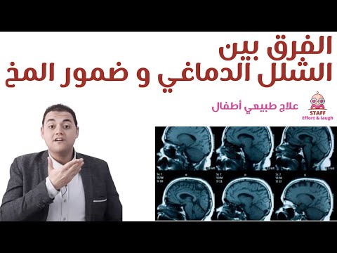 الفرق بين الشلل الدماغي و الضمور الدماغي علاج طبيعي للشلل الدماغي و ضمور المخ علاج طبيعي أطفال
