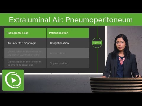 ቪዲዮ: Pneumoperitoneum ለመፍታት ምን ያህል ጊዜ ይወስዳል?