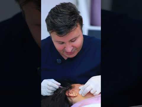 بعد لیفت با نخ چه میشود