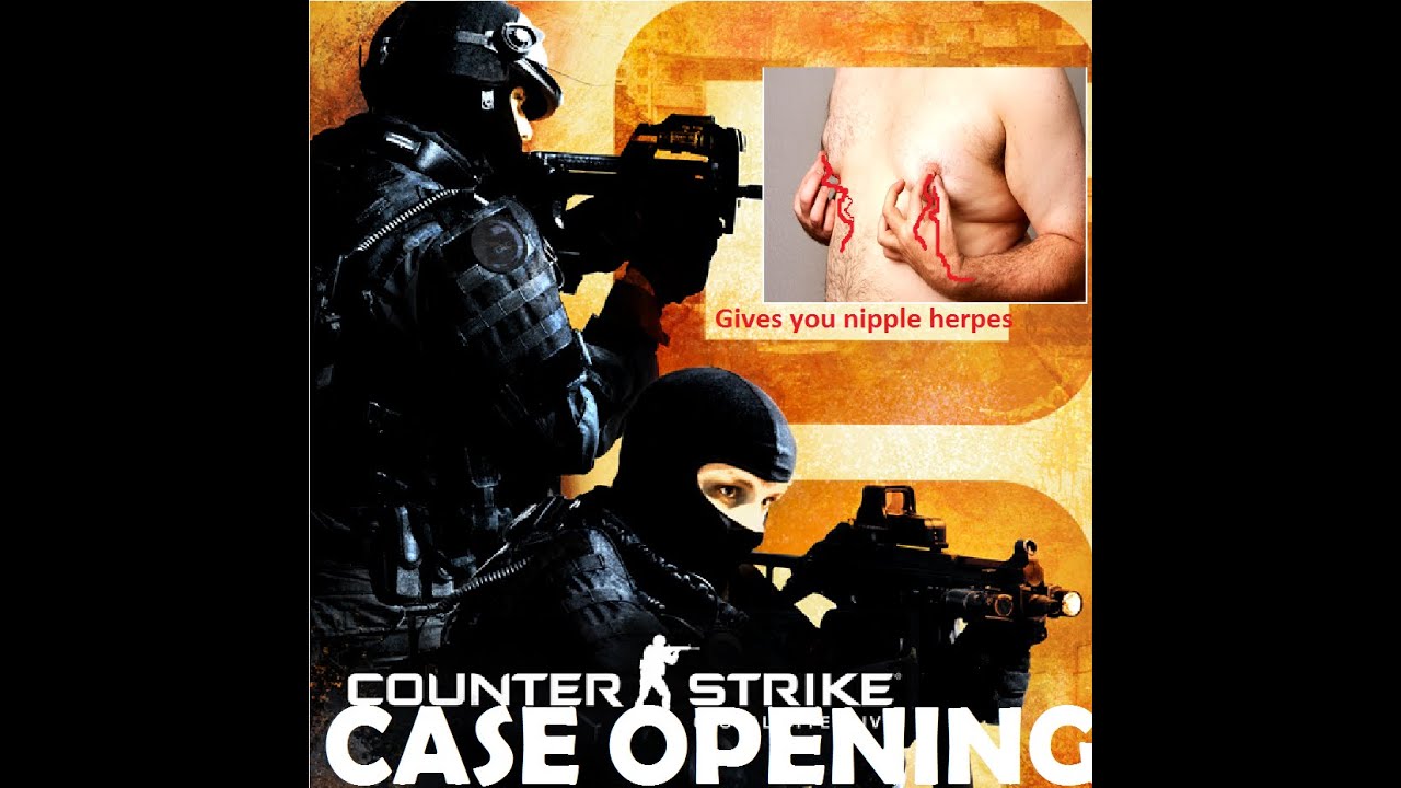 dreams and nightmares case csgo dreams and nightmares case csgo