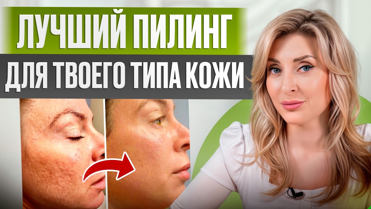После ЭТОГО пилинга ты НЕ УЗНАЕШЬ свою кожу! / ЛУЧШИЙ способ для омоложения лица