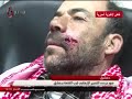 الإخبارية السورية 01 02 2015 صور جرحى التفجير في حي الكلاسة قرب القلعة في دمشق