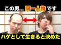 【元V系】ハゲを克服した経緯とは？〜ハゲとして生きると決めた〜