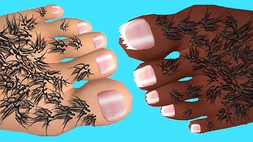 Foot Clinic - Gameplay Walkthrough - All Levels (IOS, Android)