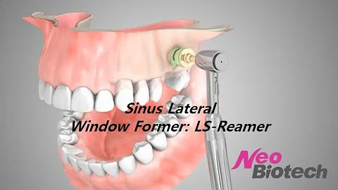 Lateral Window Formation: LS-Reamer