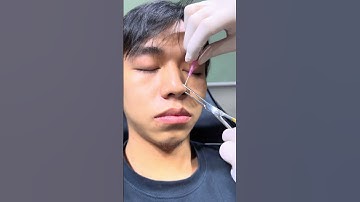 Lỗ xỏ khuyên được 1 tháng thì nên làm gì // 3 điều mà bạn nên biết