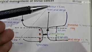 Colorectal Polyps and Cancer | Rectum and Anal Canal | General Surgery for NEET-PG mbbs tricks