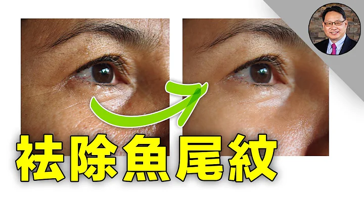 怎樣用自然方法消除魚尾紋？ - 天天要聞