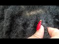 THE DIFFERENCE BETWEEN DEAD CELLS AND ACTUAL BUILDUP IN YOUR LOCS
