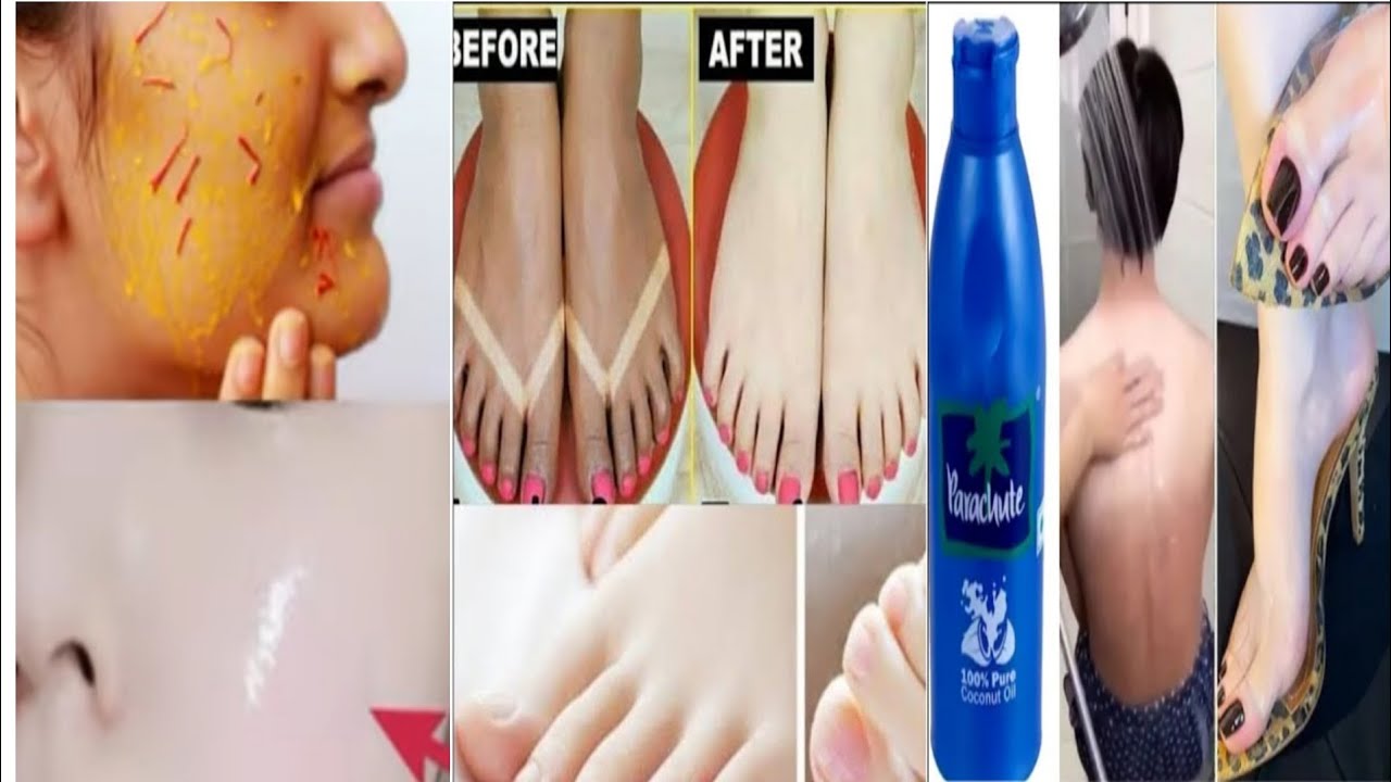 Coconut oil and turmeric for skin whitening Skin whitening home