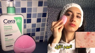 جربت أشهر غاسول وجه في العالم لمدة تلات أيام | IUsed ceraVe skincare for 3Days