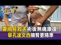 台中妻「捐腎救夫」留下最美傷痕！「單孔達文西」摘腎更精準 術後2天無痛康復【東森醫起看】
