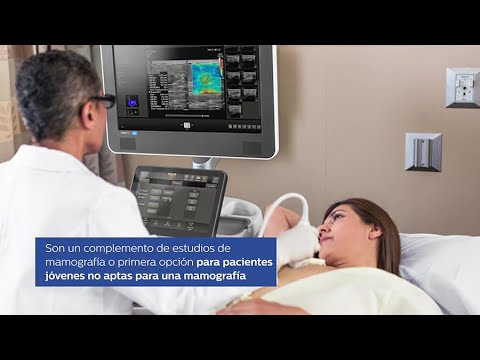 Vídeo: Ultrasonido De Las Glándulas Mamarias: Preparación, Contraindicaciones