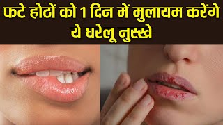 फटे होठों को सिर्फ 1 दिन में मुलायम बना देंगे ये घरेलू नुस्खे|How to get rid of Chapped Lips|Boldsky screenshot 2