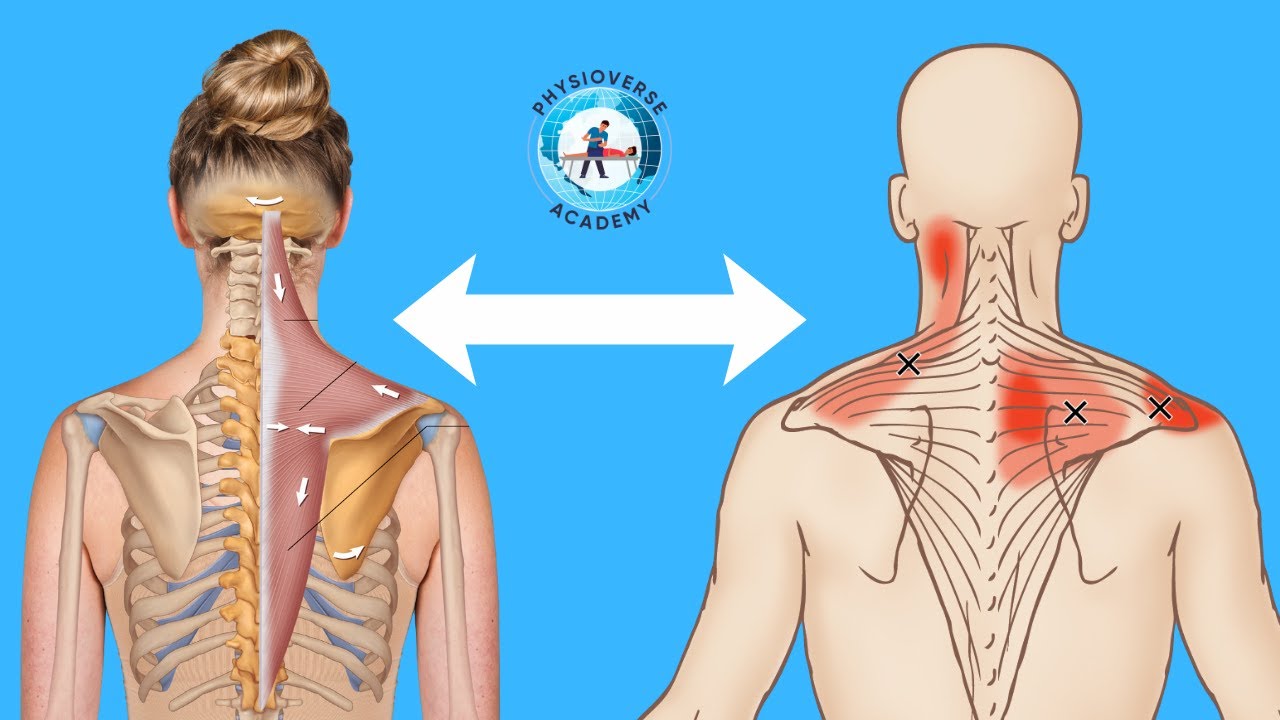 TRAPEZIUS - Funkcionalna anatomija, Dijagnostika i Ciljana terapija