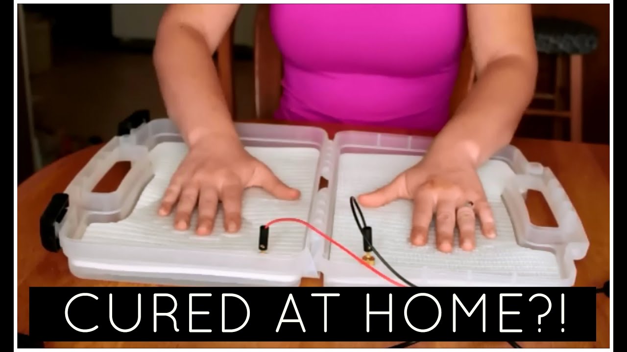 Curing Hyperhydrosis at home demo using Iontoderma iD-10000 - YouTube