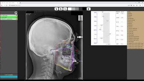 Ceph Analysis with AI | Imagoworks Technology