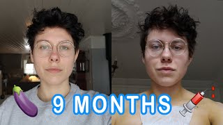 9 months on T - TMI!!! | FTM Trans Guy