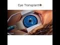 Трансплантация глаза/Eye transplant