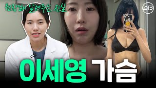 A컵에서 E컵이 가능해? 가슴수술 리뷰 (ft.이세영) | 에이비성형외과