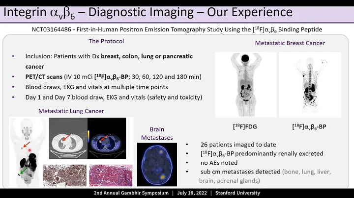 1:00pm - 1:25pm: Molecular Imaging: Imaging Integrins, Bench to Bedside