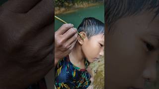 Download Lagu cara mengobati telinga yang kemasukan air saat berenang MP3 Download Lagu cara mengobati telinga yang kemasukan air saat berenang MP3