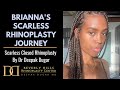 Brianna's (Ethnic Nose Job) Rhinoplasty Journey - Dr. Deepak Raj Dugar, Beverly Hills California