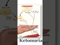 Ketonuria #ketonebodies #kidney #kidneyhealth