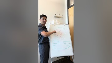 How to insert a capsular tension ring