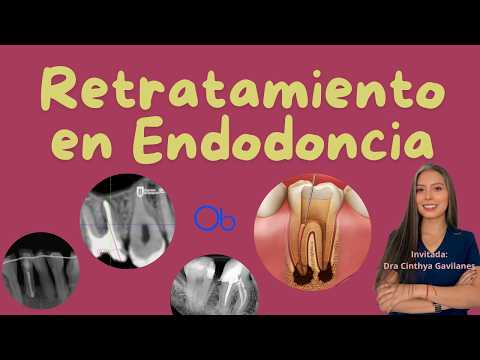 Retratamiento en Endodoncia 🦷 con Dra Cinthya Gavilanes