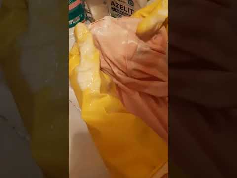 Азелит и пятна от дезодоранта.