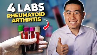4 Rheumatoid Arthritis LABS that you Need to Know! | Dr. Micah Yu