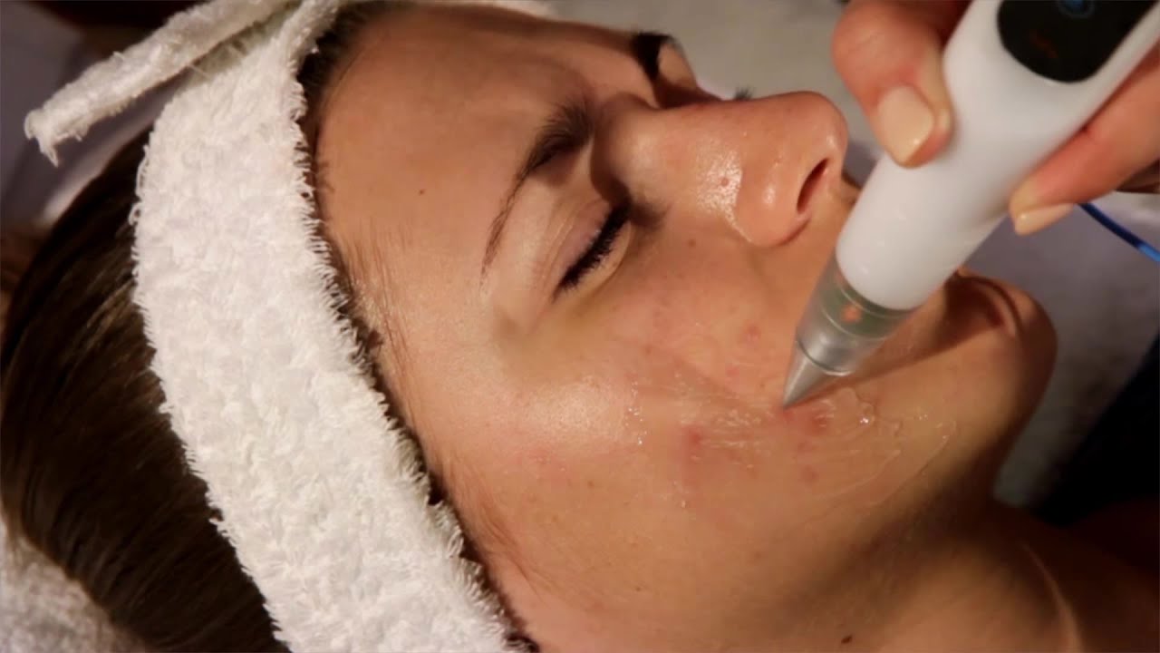 PONTEIRAS PRATAS - JETT PLASMA LIFT