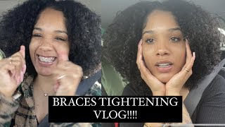 DRIVE WITH ME! BRACES TIGHTENING VLOG / SMILE UPDATE