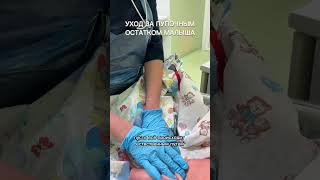 Уход за пуповиной новорожденного дома. Как мыть? Отрывать?
