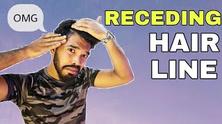 Receding Hair Line Solution | In Telugu | Ravinder’s Fashion