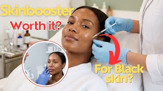 Skin Boosters Safe for Brown Skin Girls: What to Expect, Aftercare, Results & Types Explained screenshot 4