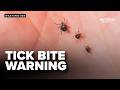Could a tick bite change what you can eat?